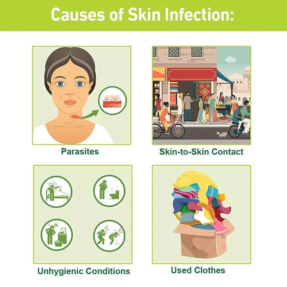 Tetmosol Medicated Soap for Scabies Skin Infection 100g Pro.