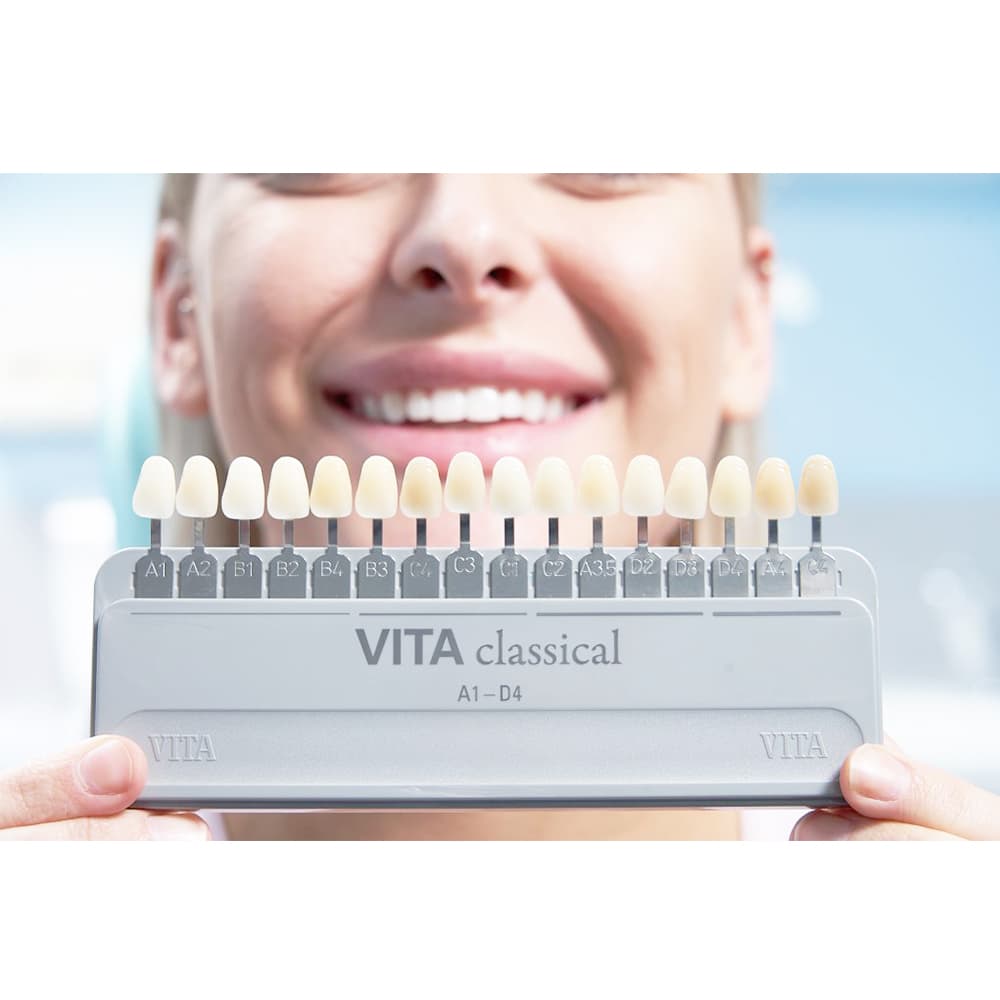 Vita Classical Shade Guide - Image 4