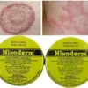 Nixoderm Cream Treat Skin Infections Eczema Pimples Blemishes Ringworm 20gm