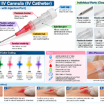 I.V. Catheter Without Injection Valve and With Wings