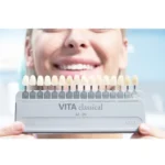 Vita Classical Shade Guide